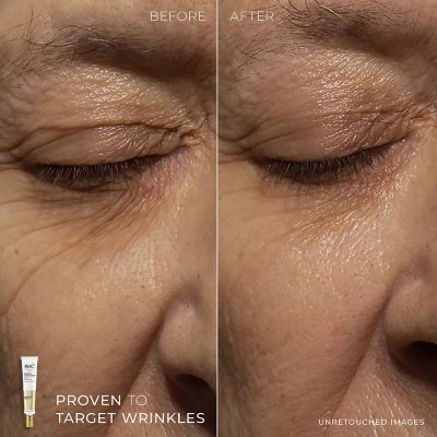 Roc Retinol Deep Wrinkle Serum & Night Cream Kit