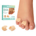 Welnove Gel Toe Separator - 8 Pack Pinky Toe Spacers - Little Toe Cushions, Small Toe Sleeves for Preventing Rubbing & Reducing Pressure (Beige)